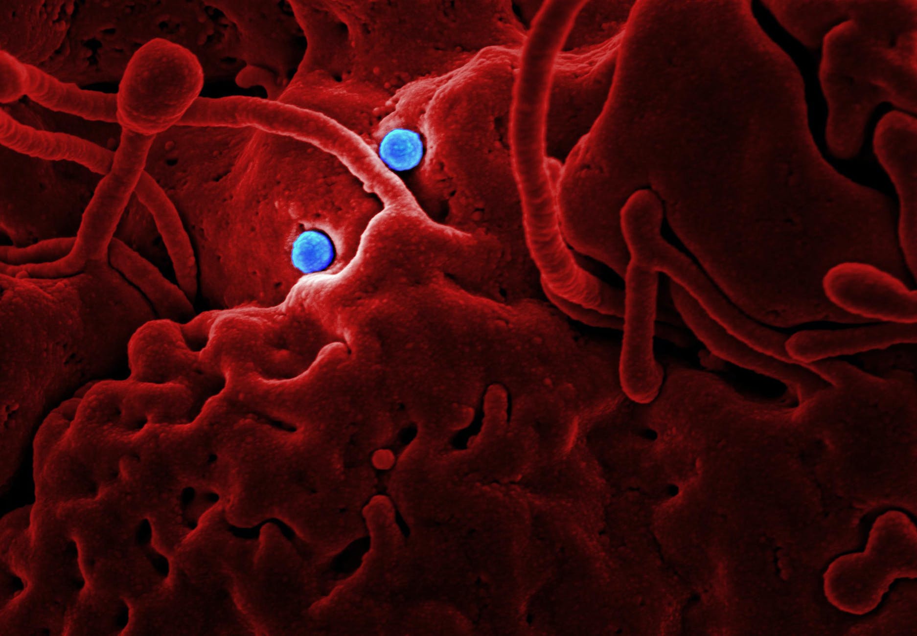 microscopic image of a virus